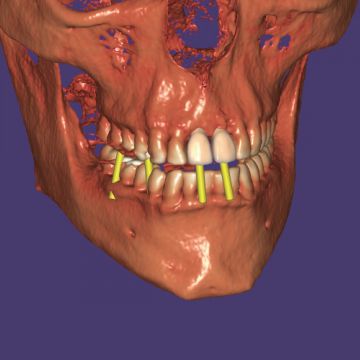 exocad® module Dicom Viewer