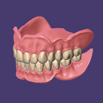 exocad® module Full Denture