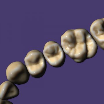 exocad® module Tooth Library ZRS