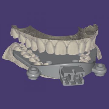 exocad® module Jaw Motion Import