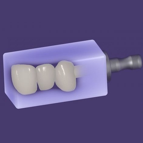 exocad® module In-CAD Nesting