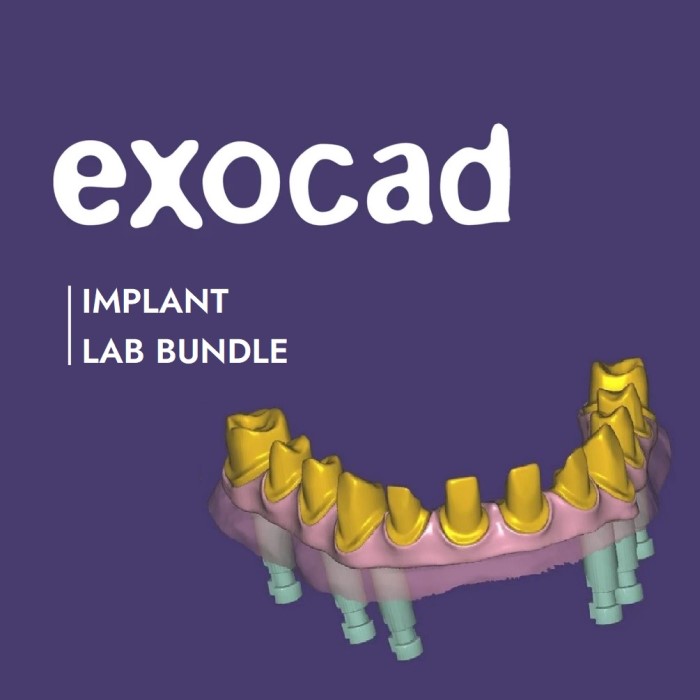 exocad® Implant Lab Bundle